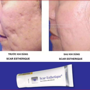 Kem xoá mờ Sẹo Thâm , Rỗ Lõm Scar Esthetique 60ml